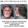 미국 병원비가 너무 비싸서 생긴 일